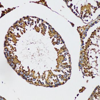 Immunohistochemistry - IRAK4 antibody (144-06208)