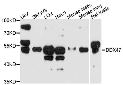 Western blot - DDX47 Polyclonal Antibody (144-600539)