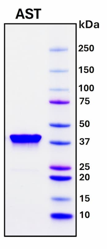 SDS-PAGE Image