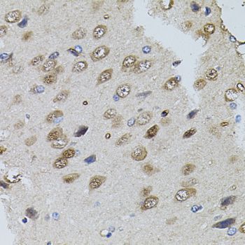 Immunohistochemistry - TRPC3 antibody (144-07742)