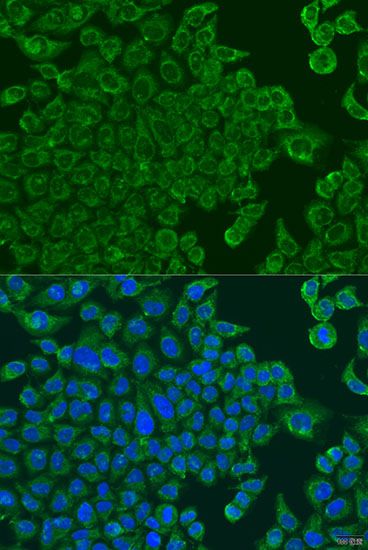 Immunofluorescence - ALOXE3 antibody (144-08245)