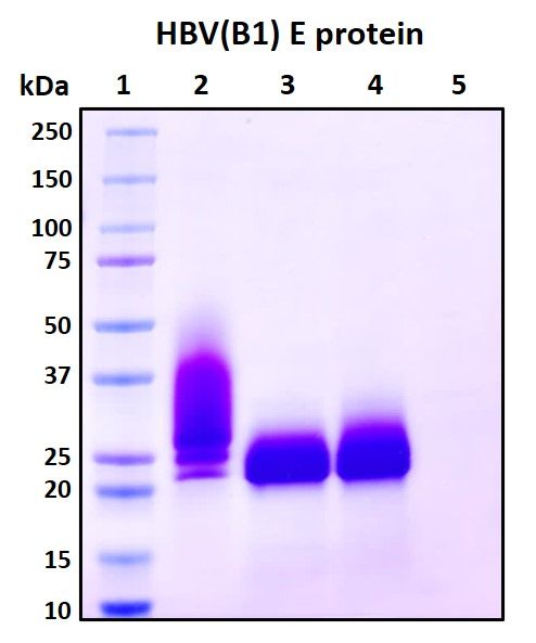 SDS-PAGE