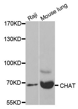 Western blot - CHAT antibody (144-02495)