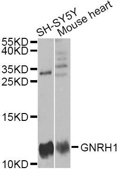 Western blot - GNRH1 antibody (144-05625)
