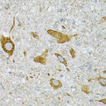 Immunohistochemistry - ST3GAL3 antibody (144-06753)