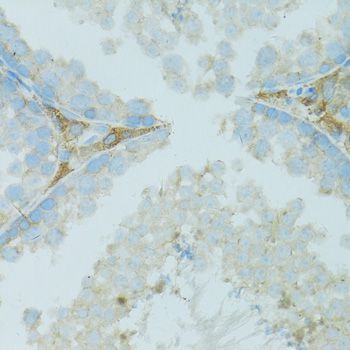 Immunohistochemistry - TJP2 Polyclonal Antibody (144-00594)
