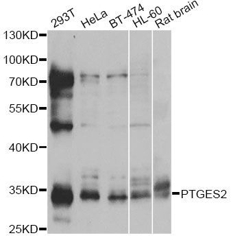 Western blot - PTGES2 antibody (144-60335)