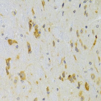 Immunohistochemistry - SCO2 Polyclonal Antibody (144-07051)