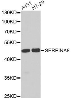 Western blot - SERPINA6 antibody (144-05803)