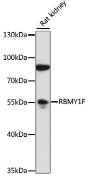 Western blot