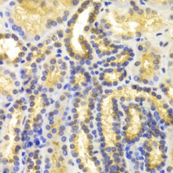 Western blot - EIF5A Polyclonal Antibody (144-02016)