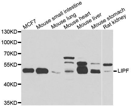 Western blot - LIPF antibody (144-07016)