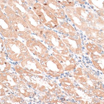 Immunohistochemistry - EGFR antibody (144-02069)