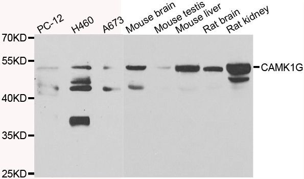 Western blot - CAMK1G antibody (144-07379)