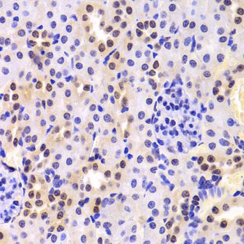 Immunohistochemistry - HNRNPA1 Polyclonal Antibody (144-07491)