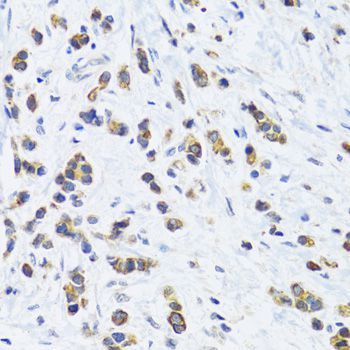 Immunohistochemistry - KRT5 Antibody (144-02662)