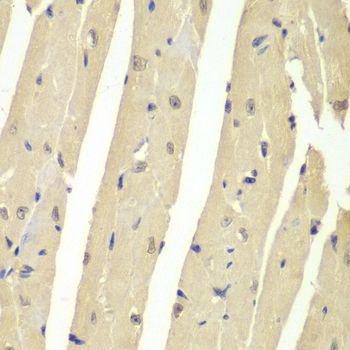 Immunohistochemistry - USP7 antibody (144-60394)