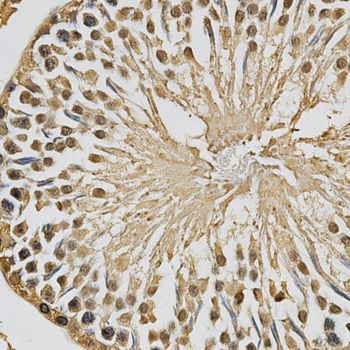 Immunohistochemistry - XRCC3 antibody (144-02134)