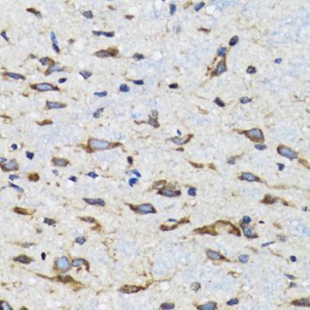 Immunohistochemistry - CDK1 Polyclonal Antibody (144-00220)