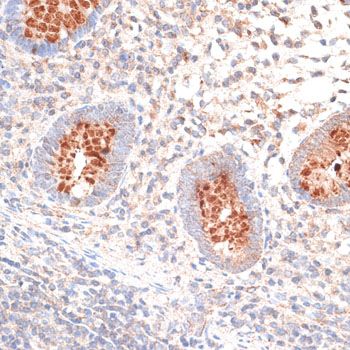 Immunohistochemistry - KIR3DL3 Polyclonal Antibody (144-10064)