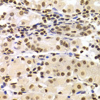 Immunohistochemistry - HMGB1 Polyclonal Antibody (144-02553)