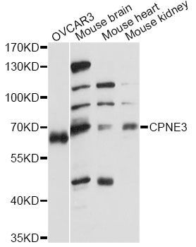Western blot - CPNE3 antibody (144-60751)