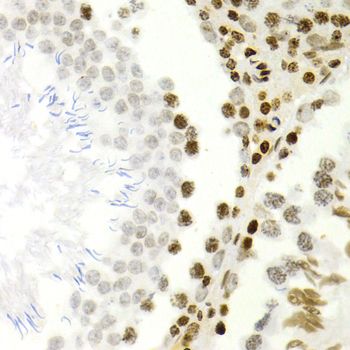 Immunohistochemistry - NFKB2 Polyclonal Antibody (144-03108)