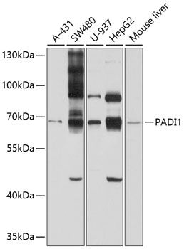 Western blot