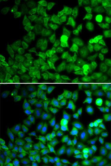Immunofluorescence - SARS antibody (144-602970)
