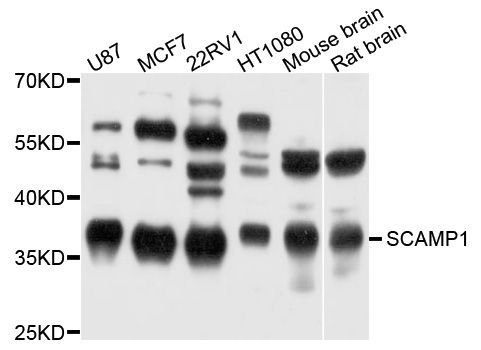 Western blot - SCAMP1 antibody (144-09092)