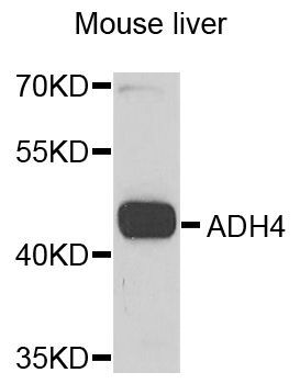 Western blot - ADH4 antibody (144-05454)