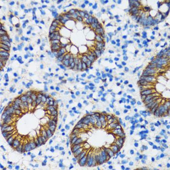 Immunohistochemistry - CTNNA1 Polyclonal Antibody (144-05635)