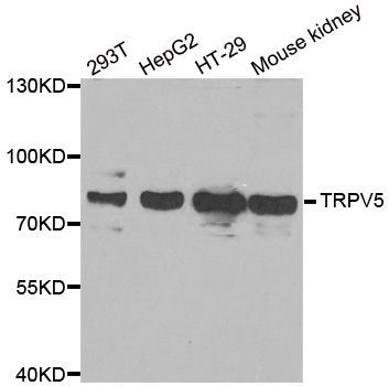 Western blot - TRPV5 antibody (144-06473)