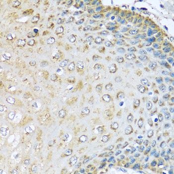 Immunohistochemistry - KCTD15 antibody (144-08256)