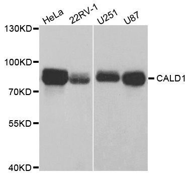 Western blot - CALD1 antibody (144-05366)