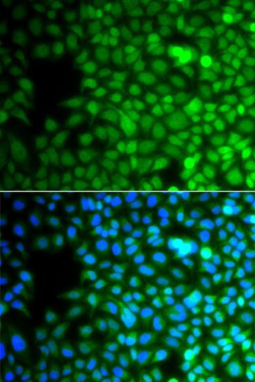 Immunofluorescence - ZNF195 antibody (144-07347)