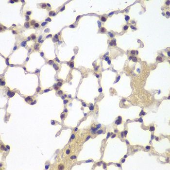 Immunohistochemistry - ESR2 Polyclonal Antibody (144-02546)