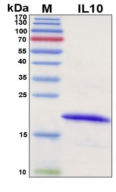 SDS-PAGE Image