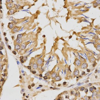 Immunohistochemistry - TriMethyl-Histone H3-K27 pAb (144-02363)
