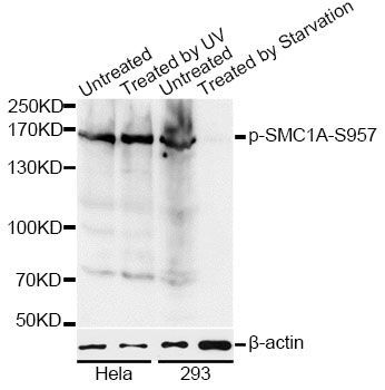 Western blot - Phospho-SMC1A-S957 pAb (144-50090)