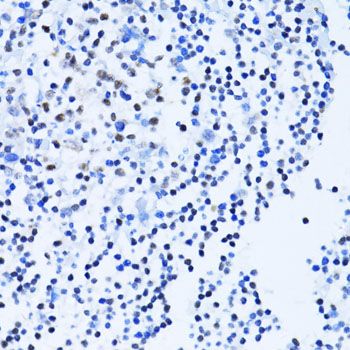 Immunohistochemistry - PARP1 Polyclonal Antibody (144-00942)