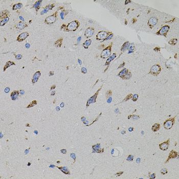 Immunohistochemistry - VEGFC antibody (144-02556)