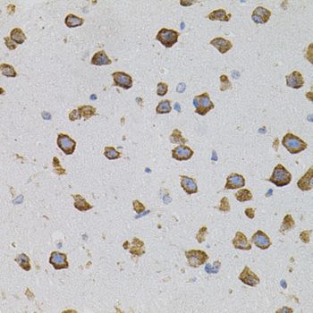 Immunohistochemistry - VEGFC antibody (144-02556)