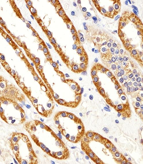 IHC-P
