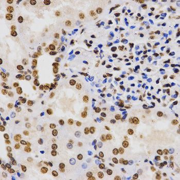 Immunohistochemistry - TriMethyl-Histone H3-K9 antibody (144-02360)