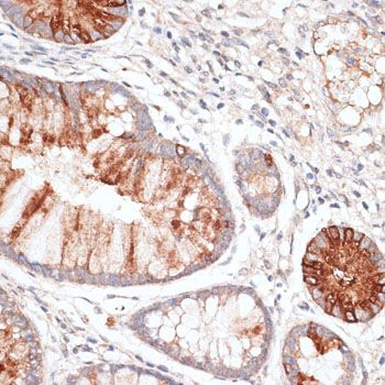 Immunohistochemistry - KIR3DL3 Polyclonal Antibody (144-10064)