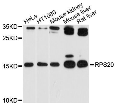 Western blot - RPS20 Polyclonal Antibody (144-10363)