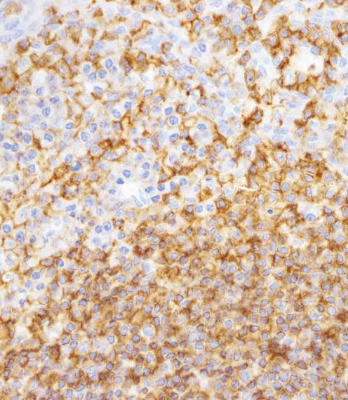 IHC