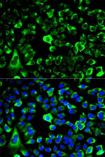 Immunofluorescence - RPS3 antibody (144-013543)