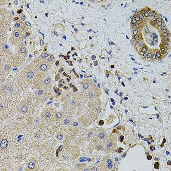 Immunohistochemistry - KTN1 antibody (144-05879)